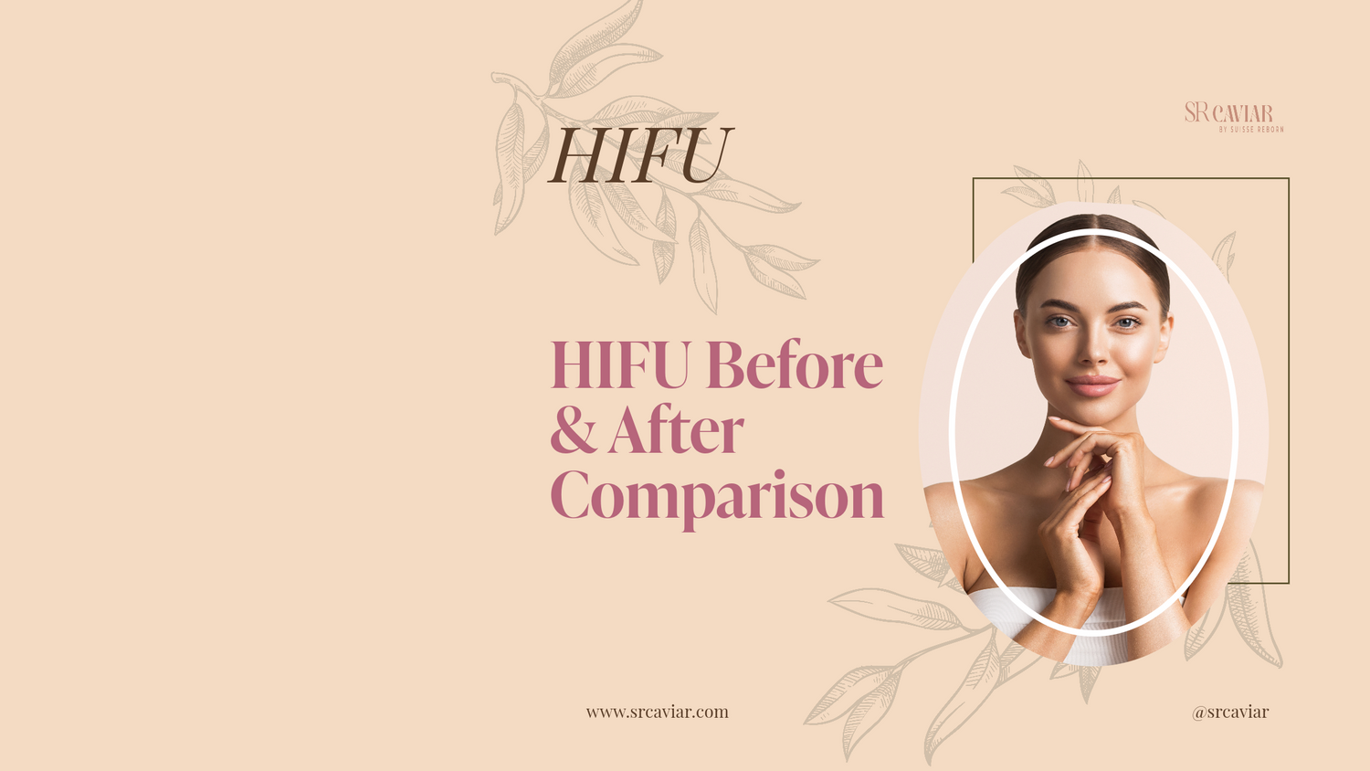 HIFU Before and After Comparison