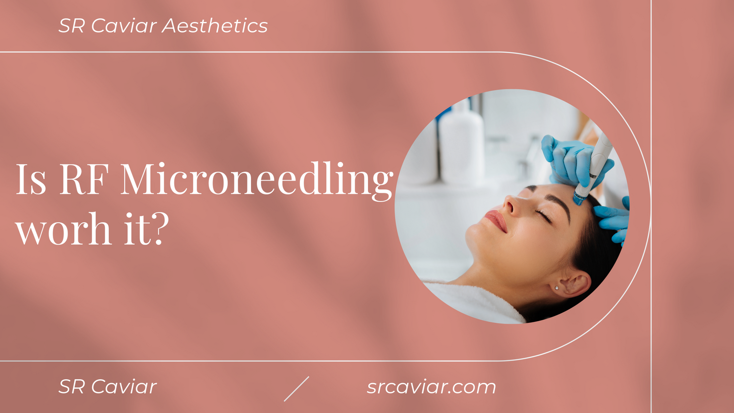 Is Microneedling with RF Worth It? A Comprehensive Guide for 2024